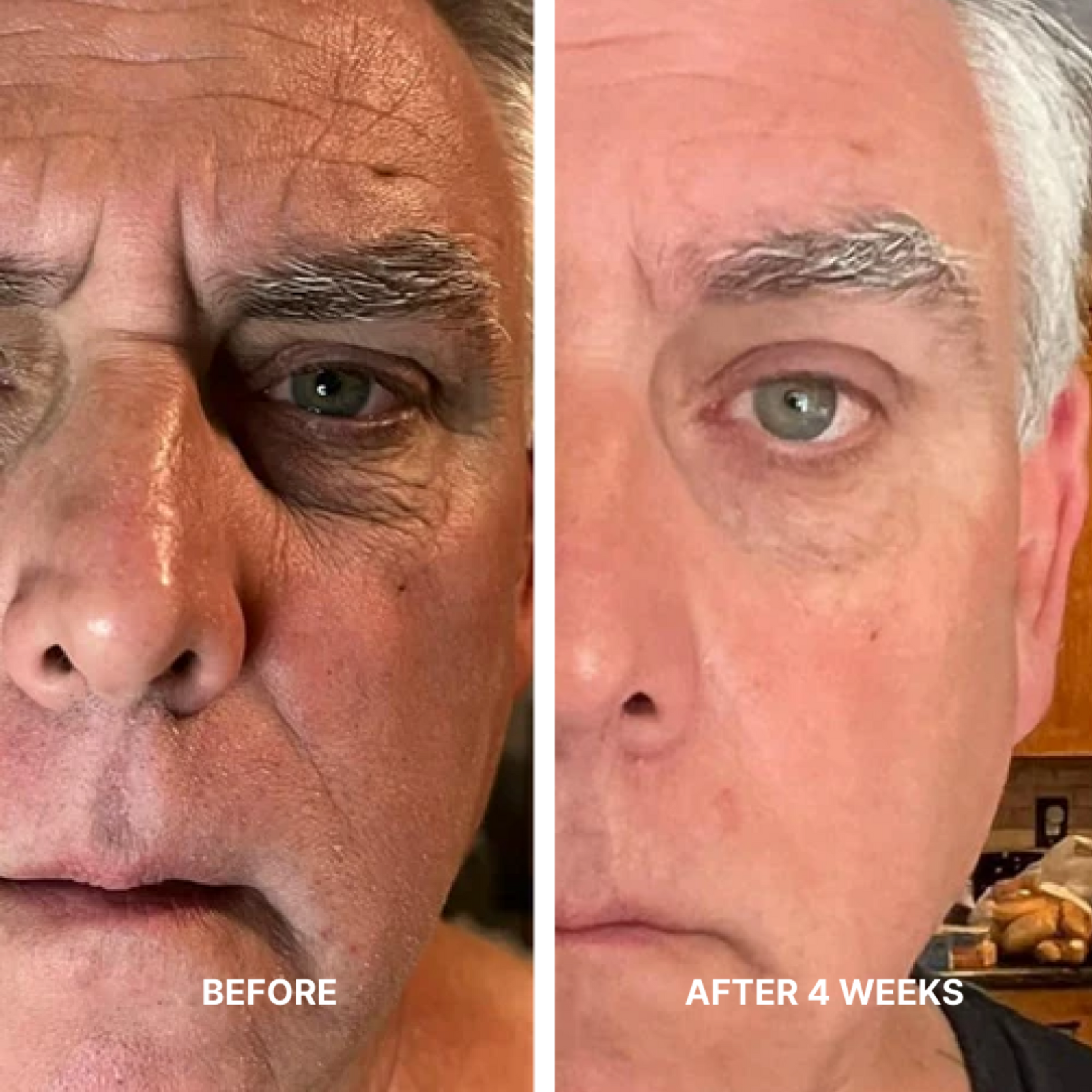 Triple Action Face Sculpting System