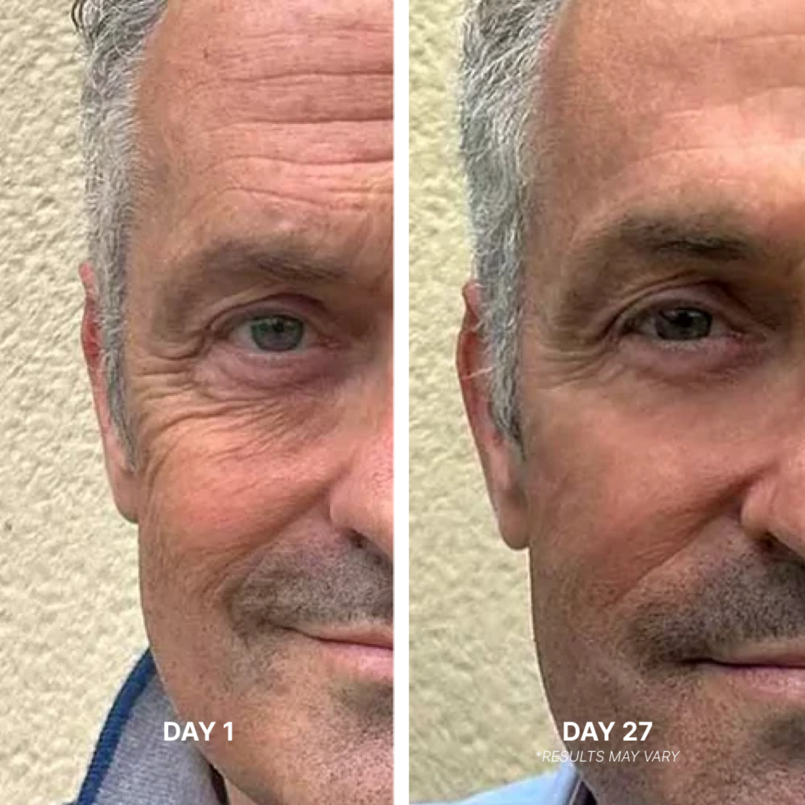 Triple Action Face Sculpting System