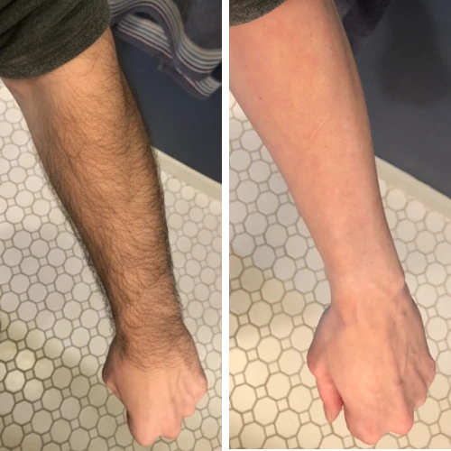 The Complete Razorless Grooming Kit