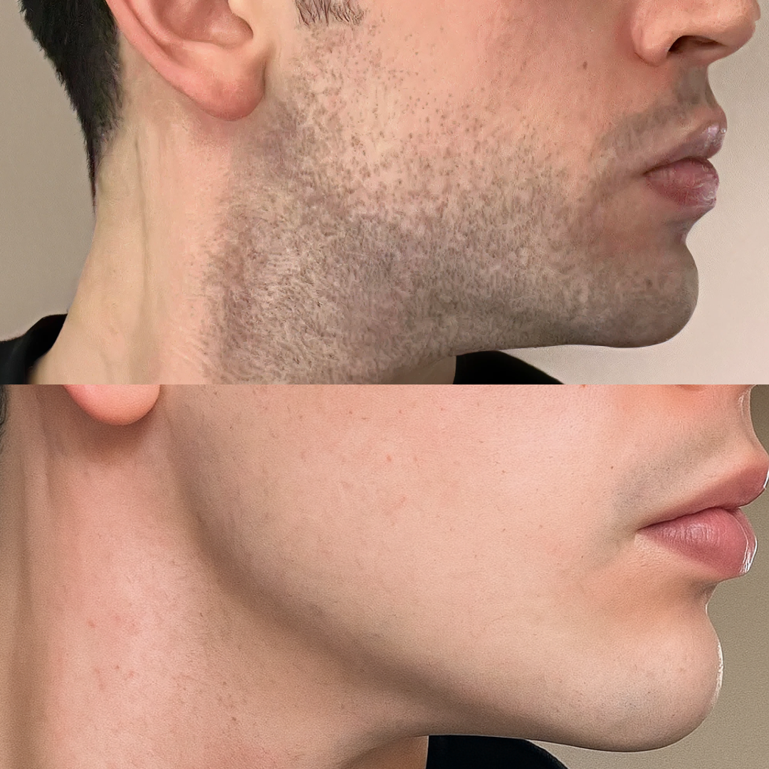 Customer result image
