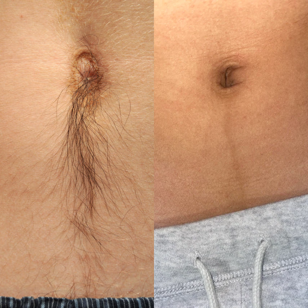 Customer result image