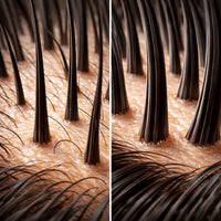 FULLER THICKER HAIR