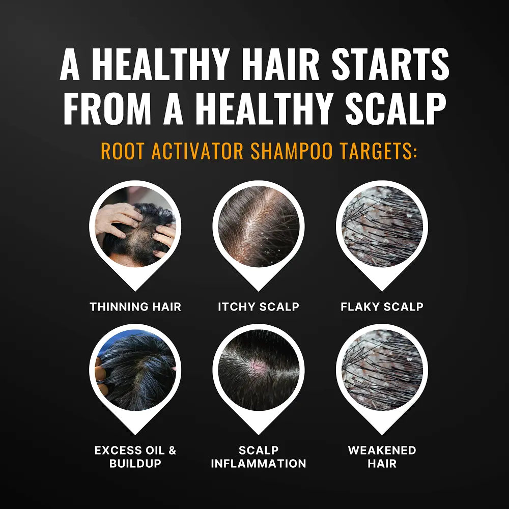 Root Activator Shampoo™ - 2266
