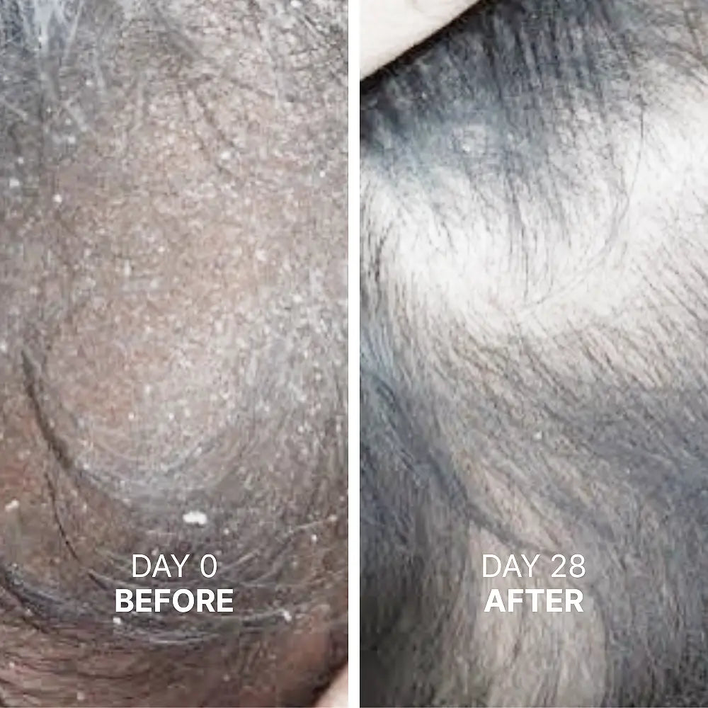 Root Activator Shampoo™ - 2266