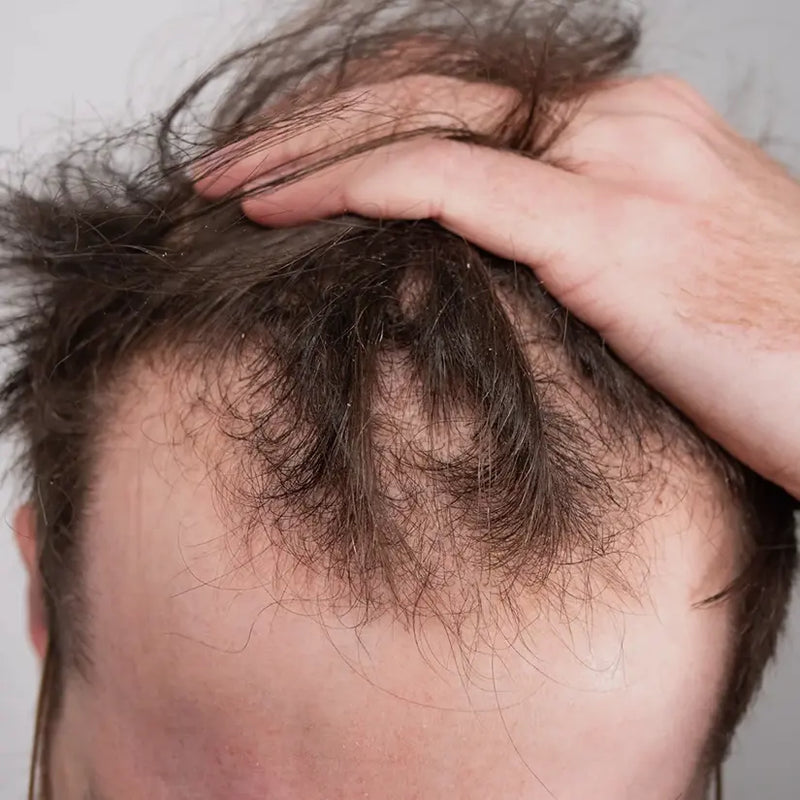 1. It Treats Your Scalp, Not Just Your Hair