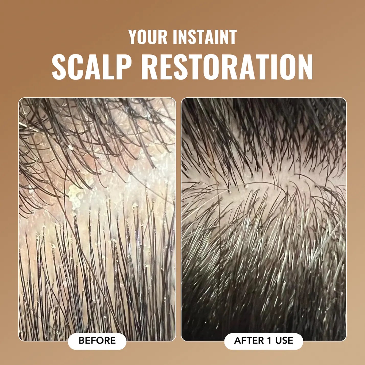 Root Resetter Scalp Scrub™ - Sale