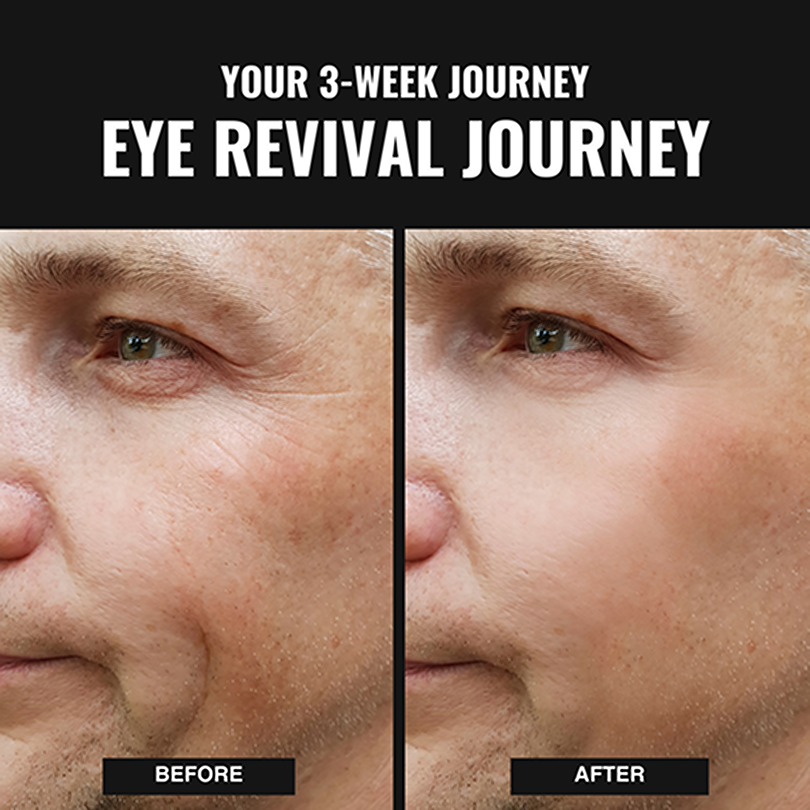 Eye Repair Stick - Sale