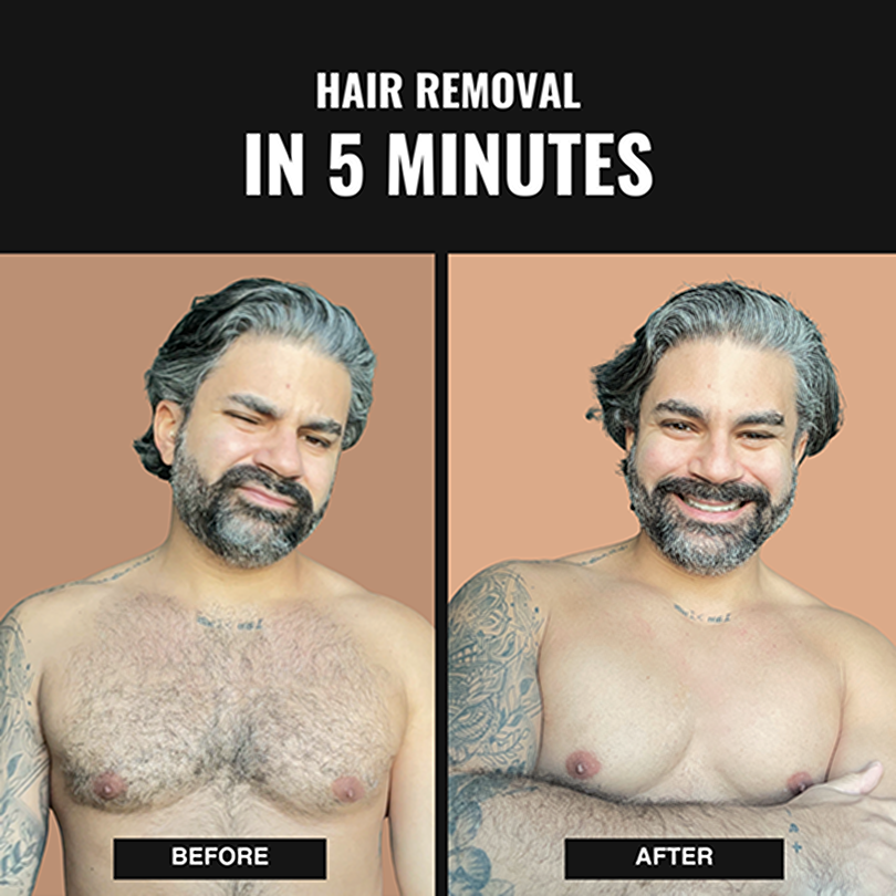 No-Shave Hair Removal Spray - 5X Value Pack
