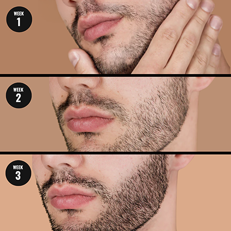 Beard Growth Oil - 5X Value Pack