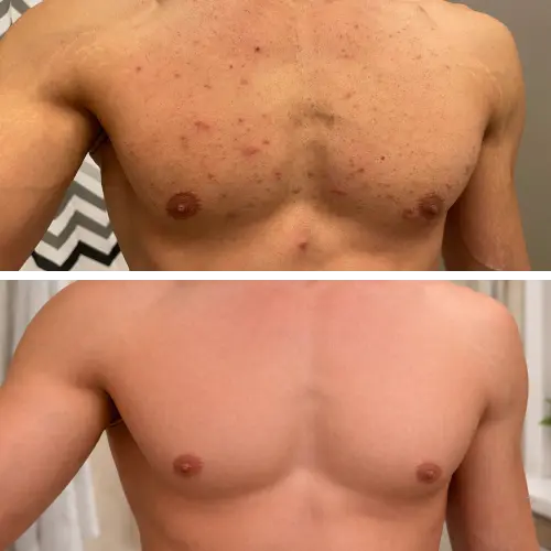 Before and After Results