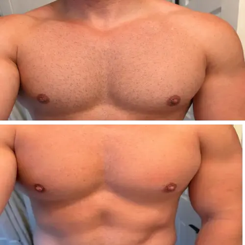 Before and After Results