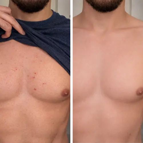 Before and After Results