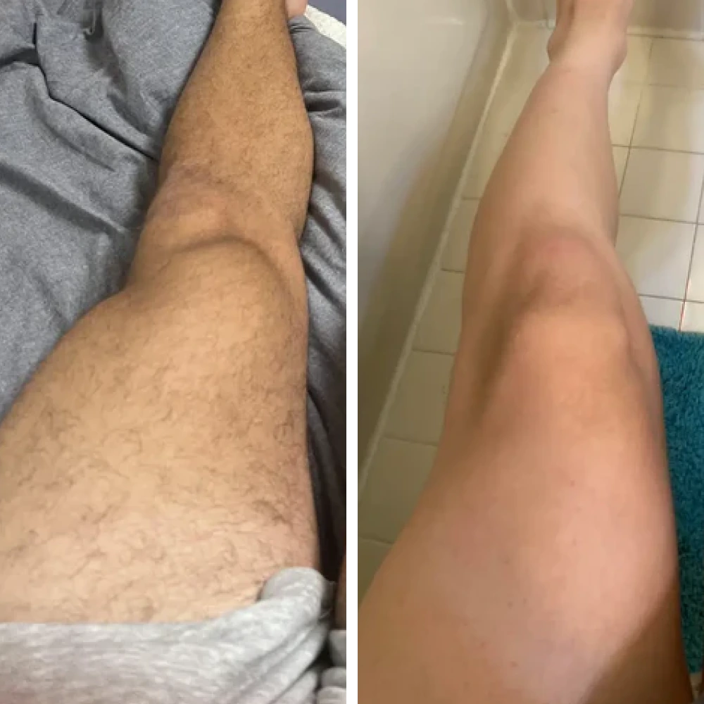 The Complete Razorless Grooming Kit