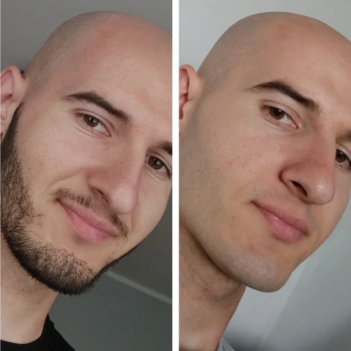 The Complete Razorless Grooming Kit