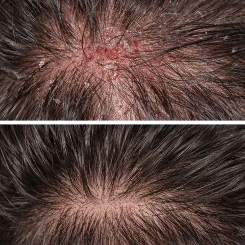 Before and After Results
