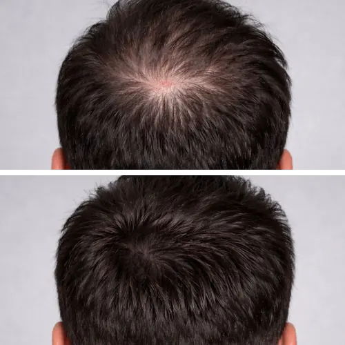 Before and After Results