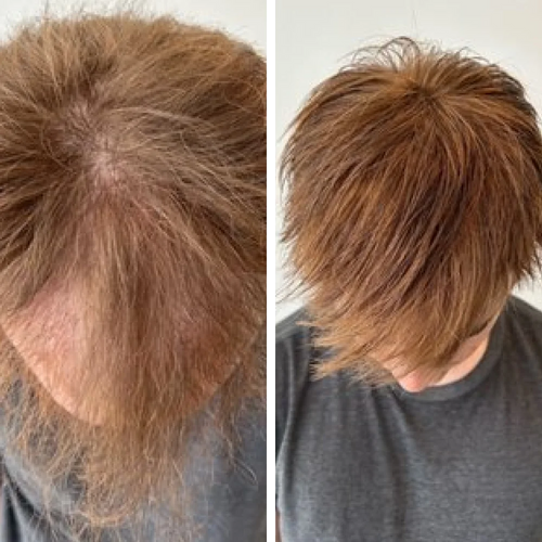 Before