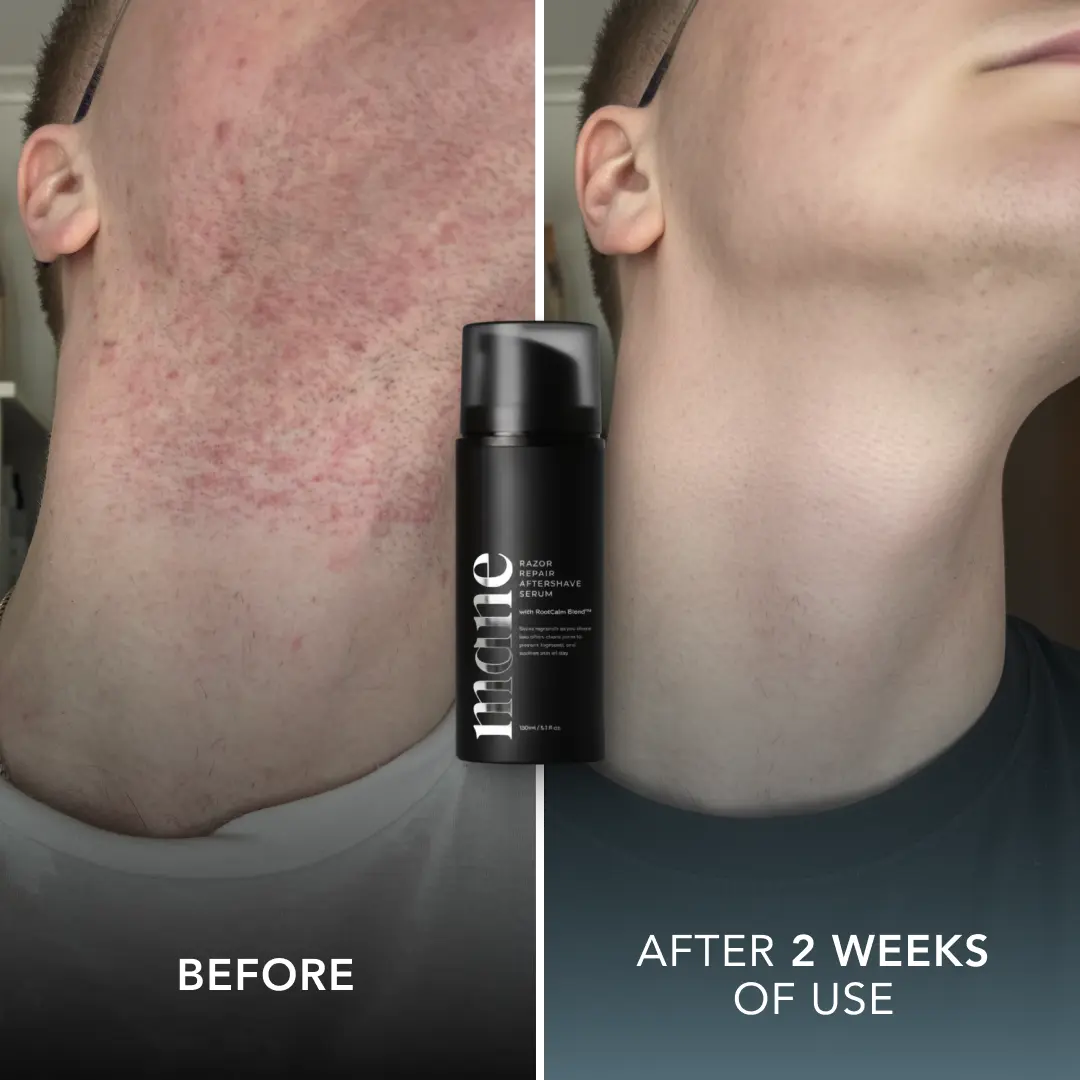 Razor Repair Aftershave Serum