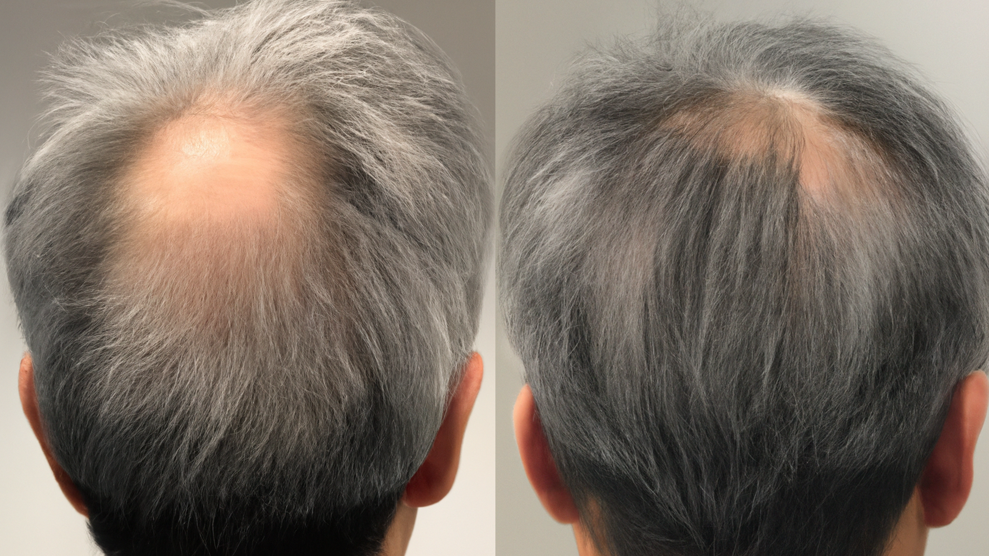 Resultados Probados para un Cabello Espectacular