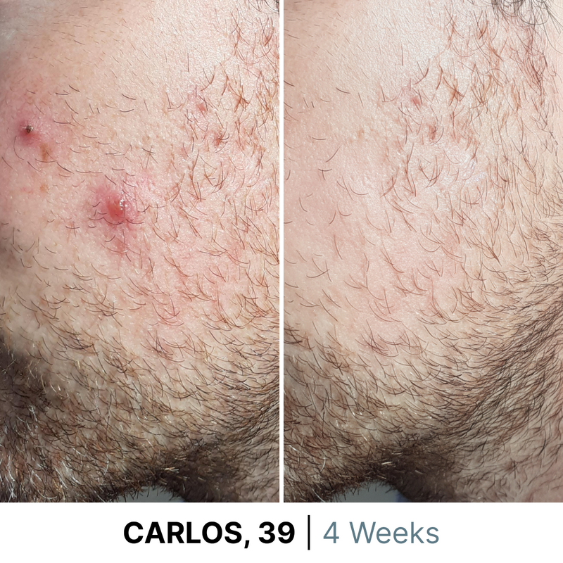 gid://shopify/MediaImage/38077171106044