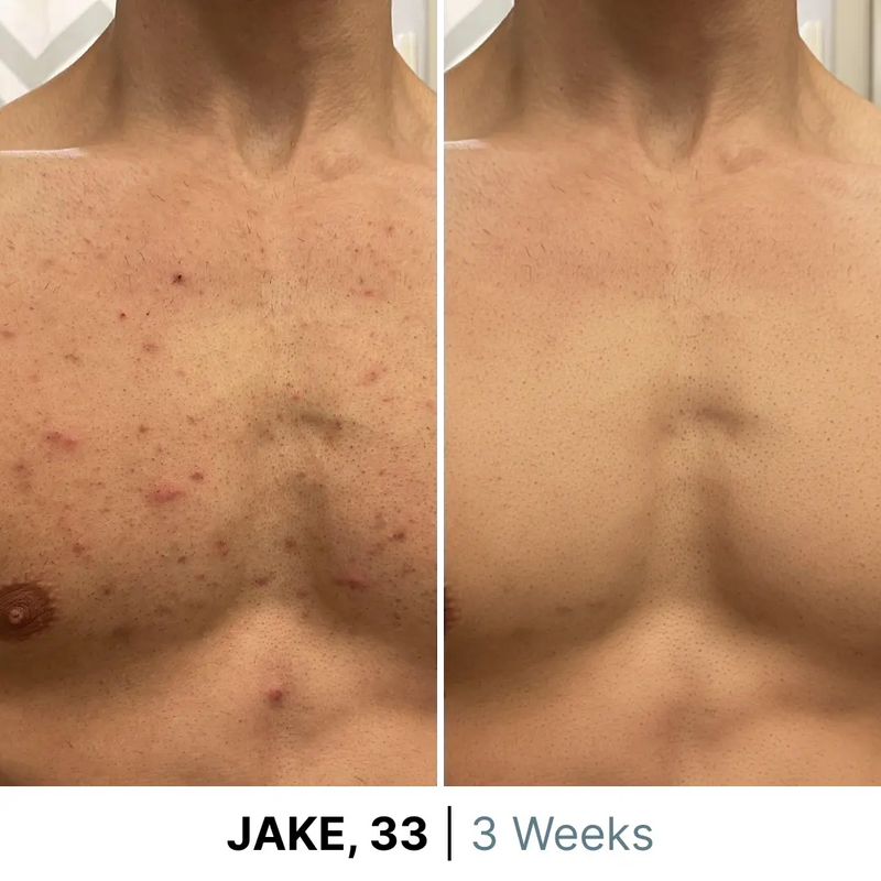 gid://shopify/MediaImage/38081644462332