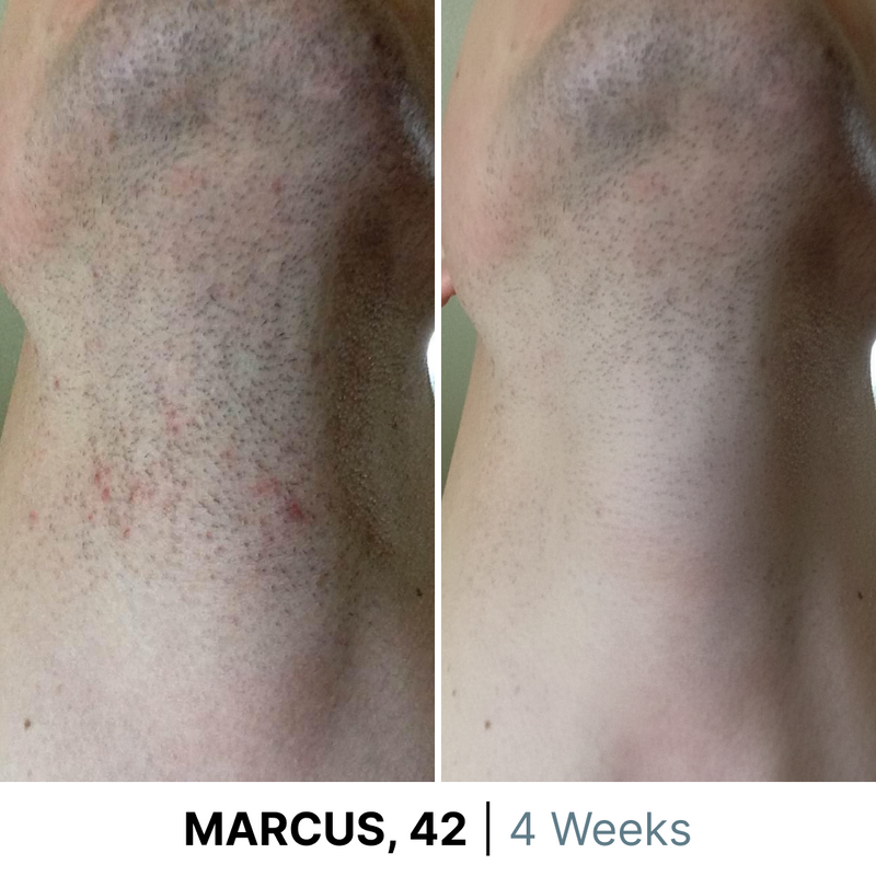 gid://shopify/MediaImage/38077171040508