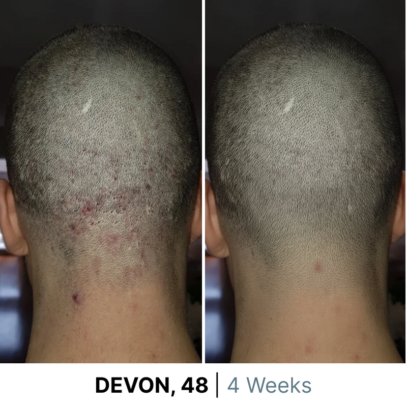 gid://shopify/MediaImage/38077171073276