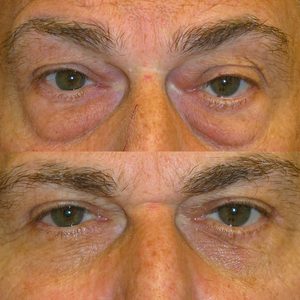 Eye Repair Stick - Superior Mane