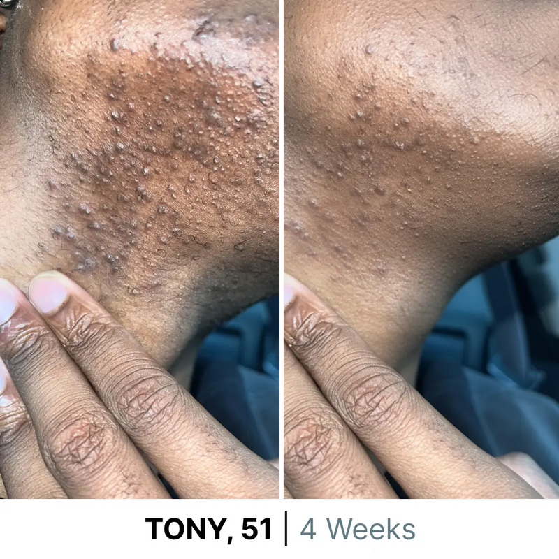 gid://shopify/MediaImage/38081644495100